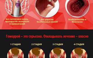 Какими народными методами геморрой лечат женщины
