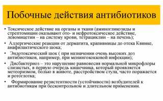 Какие 5 групп лекарственных средств назначают врачи для лечения гайморита – самые эффективные препараты