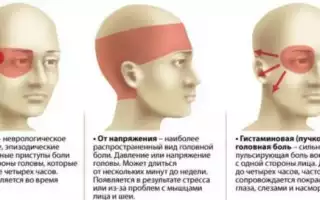 Причины головных болей после физических нагрузок