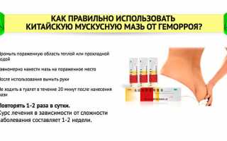 Что думают врачи о Мускусной мази от геморроя