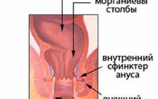Недостаточность сфинктера заднего прохода