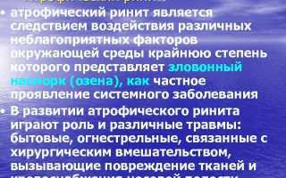 Атрофический ринит: симптомы и лечение инфекционного заболевания