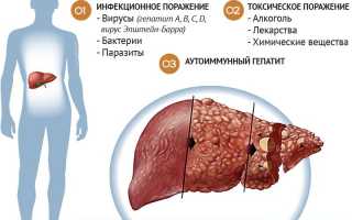 Об интоксикации печени