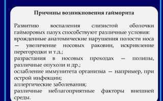 Больничный при гайморите: сколько дней держат на больничном