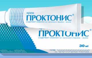 Отзывы о лечении геморроя: мазь Проктонис