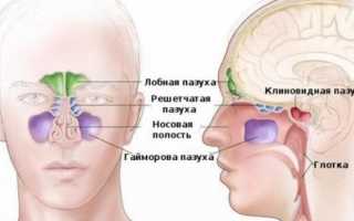 Насколько опасно попадание пломбировочного материала в гайморовы пазухи, как вовремя избежать неприятных последствий и удалить инородное тело