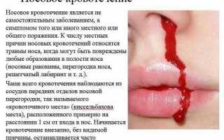 12 причин возникновения кровотечений из носа