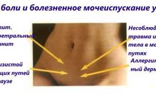 Все ситуации, когда болит низ живота и отдает в заднем проходе