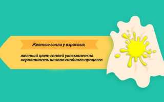 Сопли желтого цвета у взрослого: причины и лечение