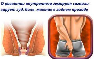 Какими свечами пользоваться для избавления от внутреннего геморроя?
