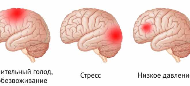 Почему от голода сильно болит голова
