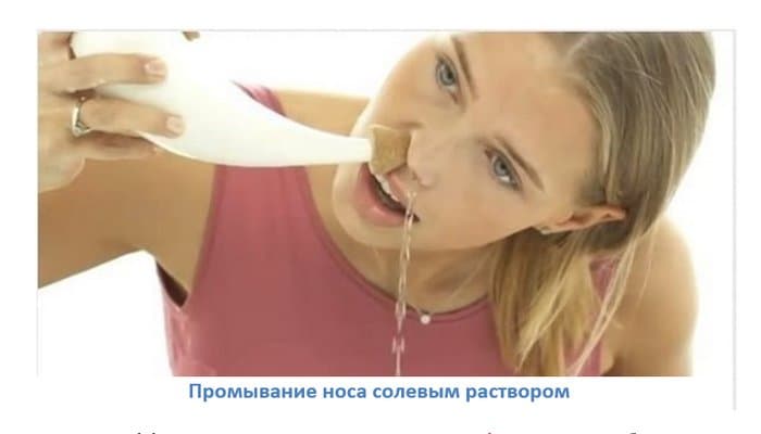 _