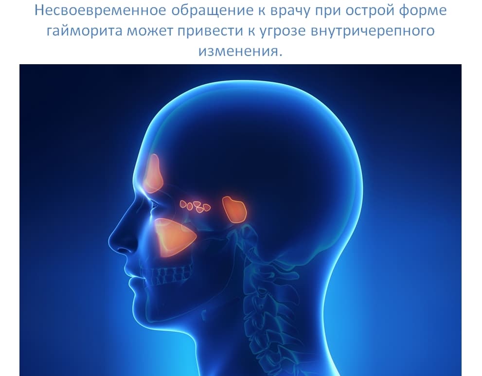 _
