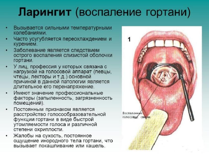 _