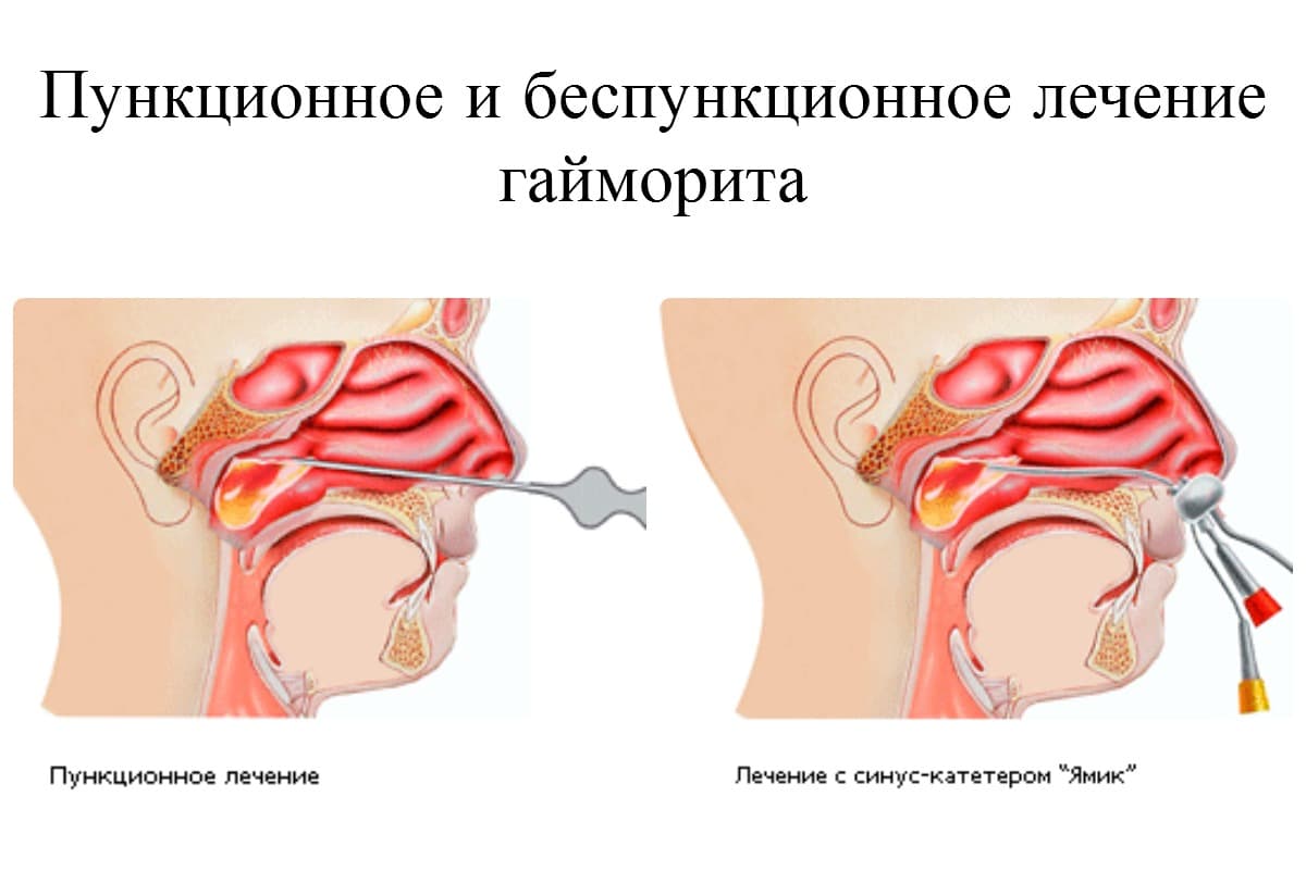 _