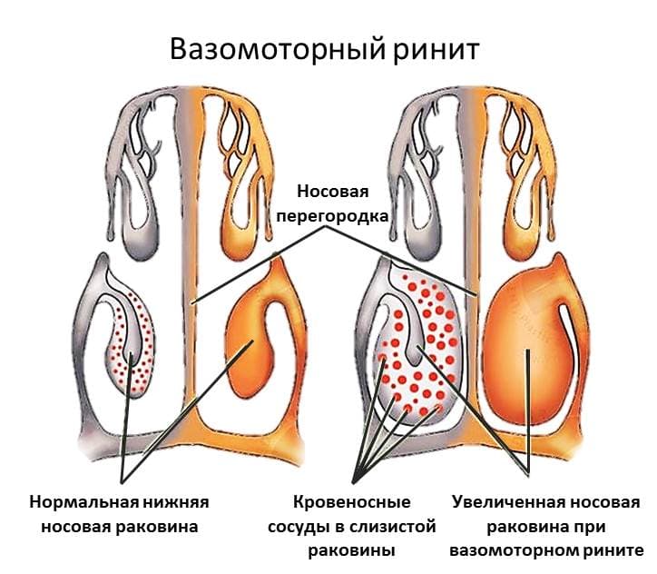 _