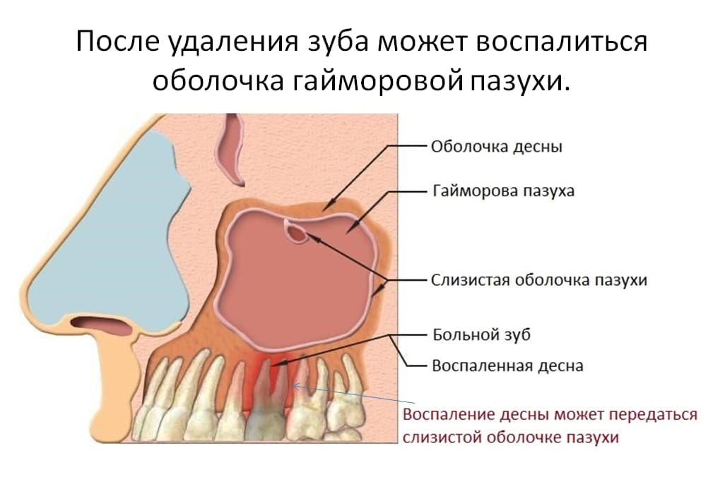 _
